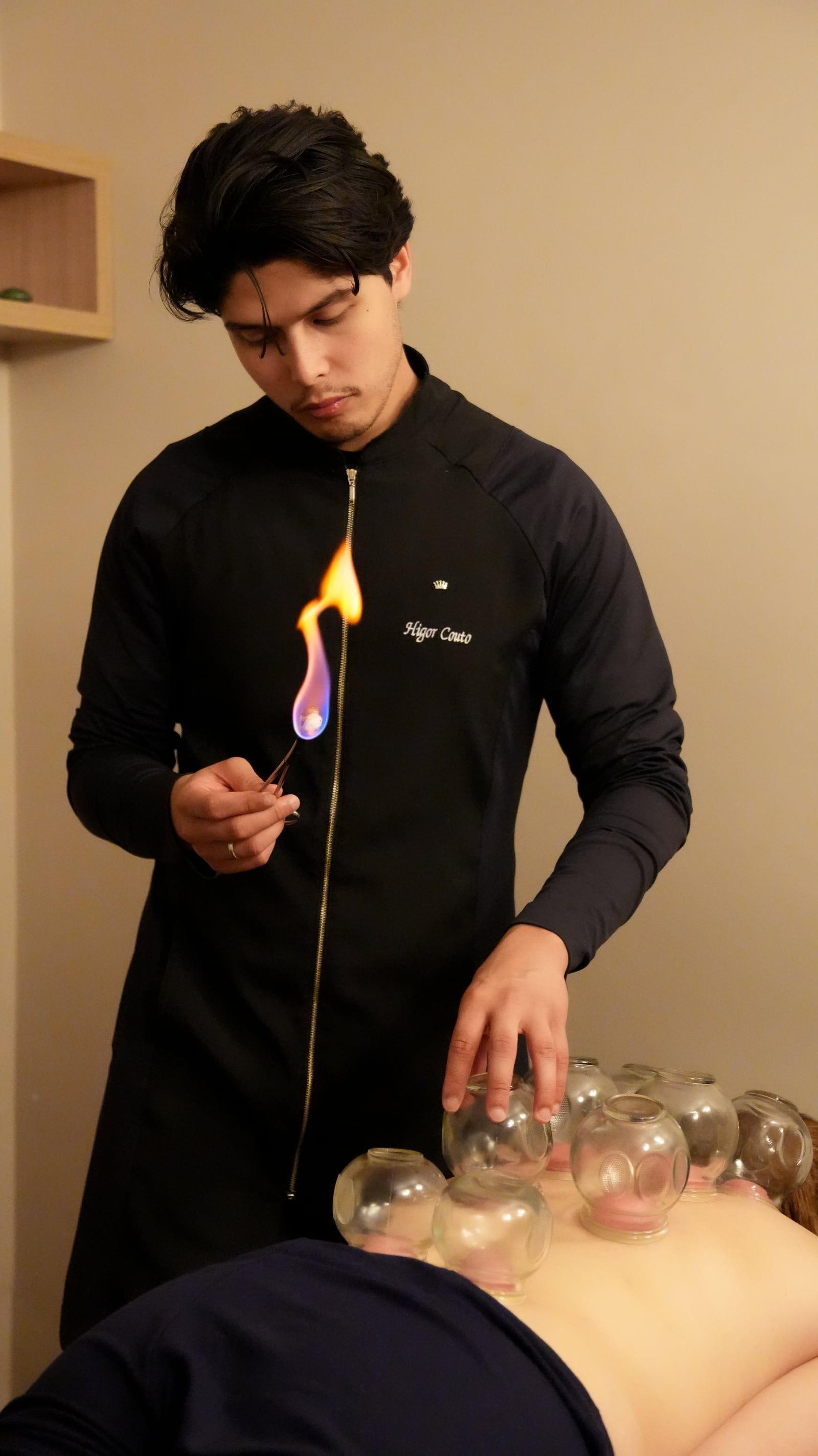 Higor Couto aplicando ventosas de vidro nas costas de uma paciente